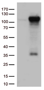 ROR2 Antibody