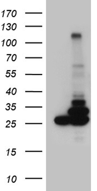 ROR2 Antibody