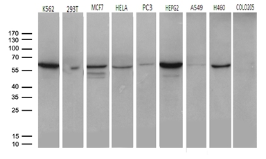 ROR2 Antibody