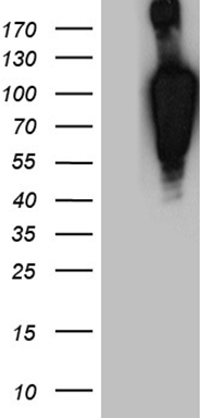 ROR2 Antibody