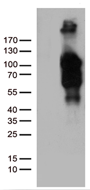 ROR2 Antibody