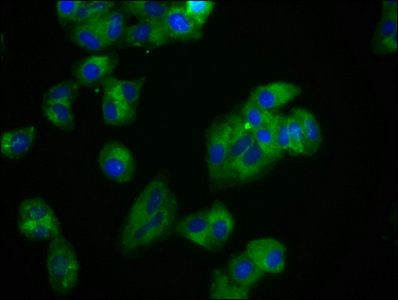 ROR2 antibody