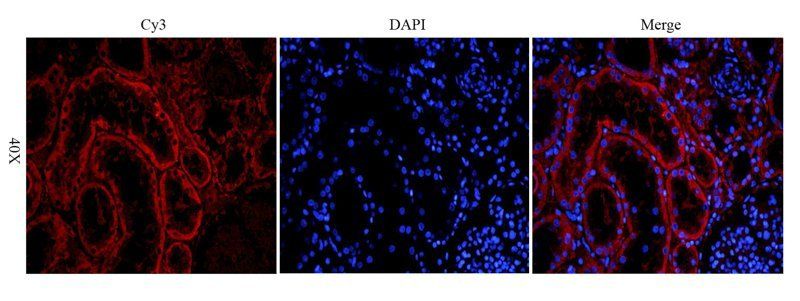 ROR2 antibody