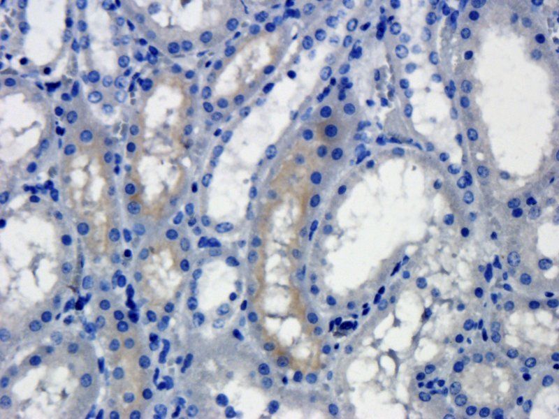 ROR2 antibody