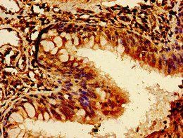 ROR2 Antibody