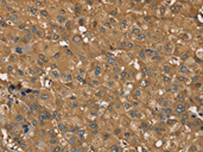 RORB Antibody