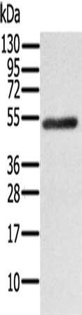 RORB antibody