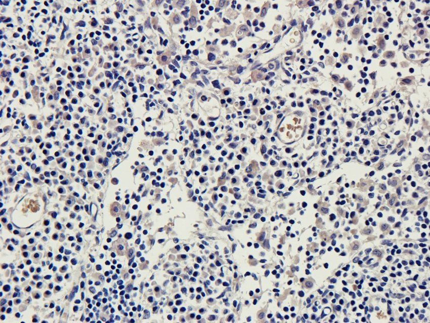 ROS1 antibody