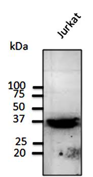RPS6 Antibody