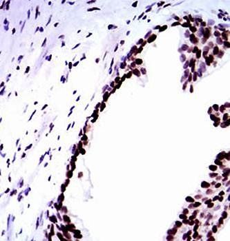 RPA1 Antibody