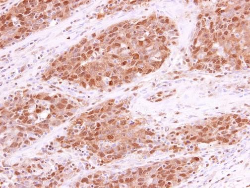 RPA70 antibody [C1C3]