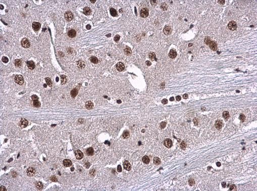RPA70 antibody [C1C3]