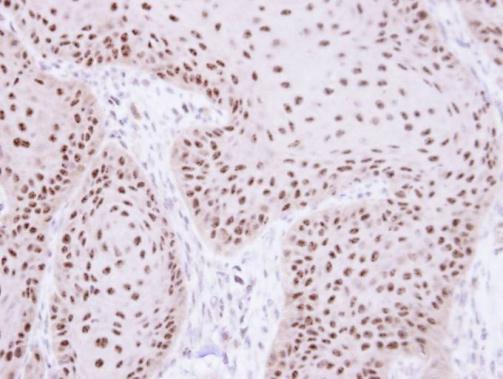RPA70 antibody [C1C3]