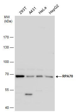 RPA70 antibody