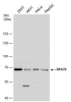 RPA70 antibody [C1C3]