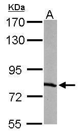 RPA70 antibody