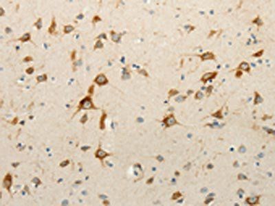 RPAP3 Antibody