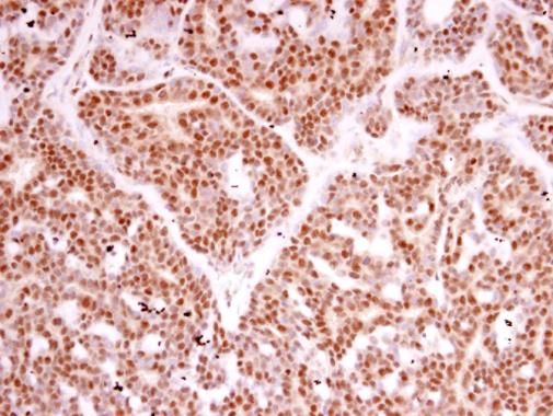 RPB2 antibody [N1], N-term