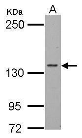 RPB2 antibody [N1], N-term