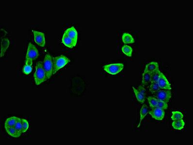 RPGR Antibody