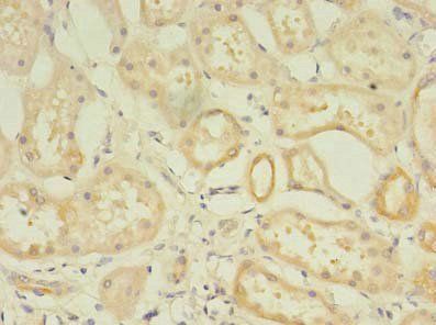 RPGR Antibody