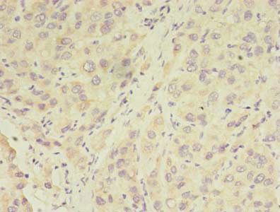 RPGR Antibody