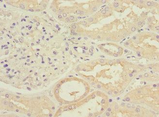RPGRIP1 Antibody