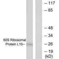 RPL10 antibody