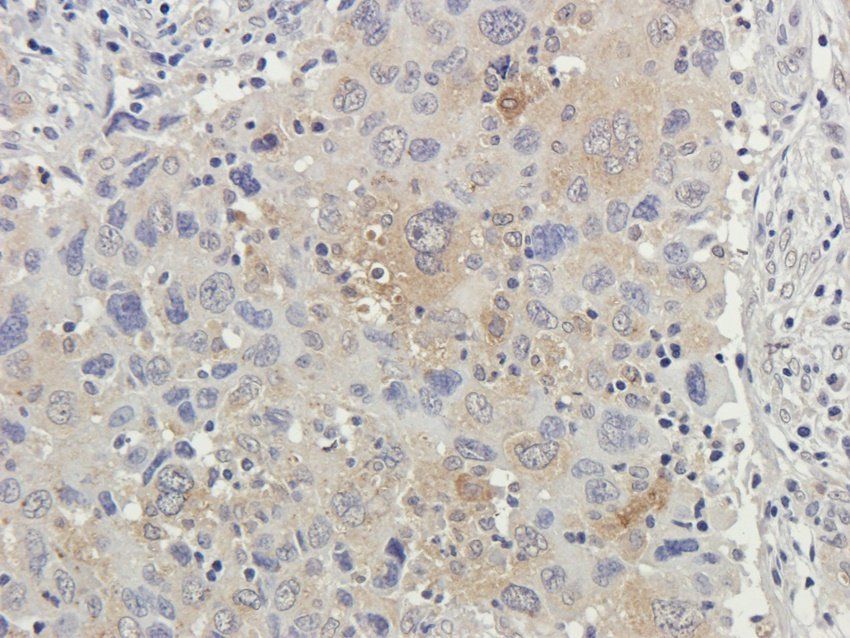 RPL10A antibody