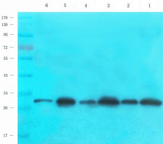 RPL10A antibody