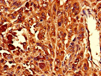 RPL10L Antibody