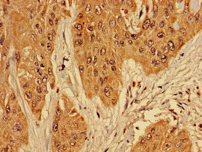 RPL10L Antibody