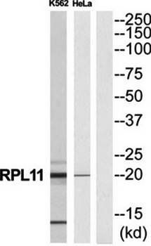 RPL11 antibody