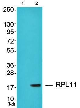 RPL11 antibody