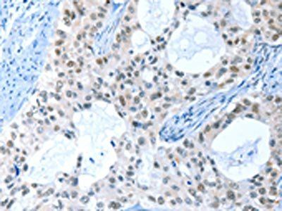RPL15 Antibody