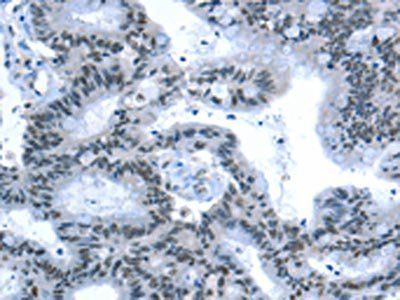 RPL15 antibody