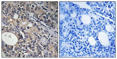 RPL17 Antibody