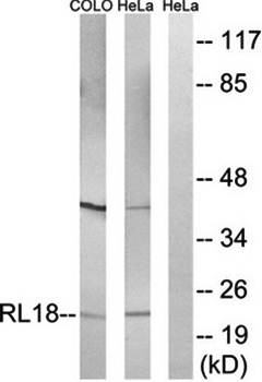 RPL18 Antibody