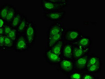 RPL23A antibody