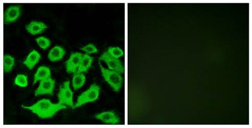 RPL36 Antibody