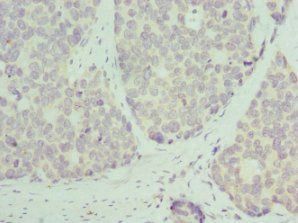 RPL9 Antibody