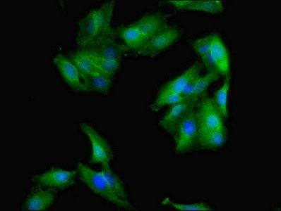 RPLP0 Antibody