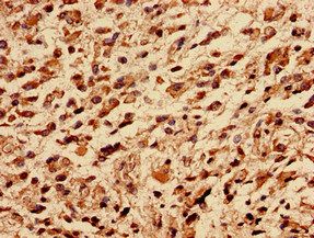 RPLP0 Antibody