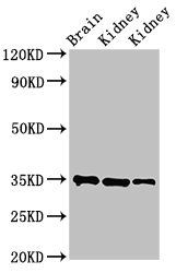 RPLP0 Antibody