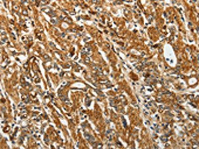 RPLP0 Antibody
