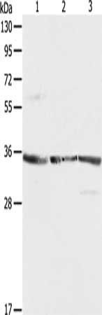 RPLP0 Antibody