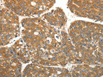 RPLP0 Antibody