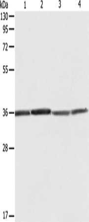 RPLP0 Antibody