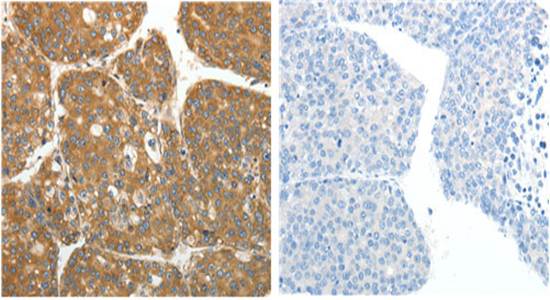 RPLP0 Antibody