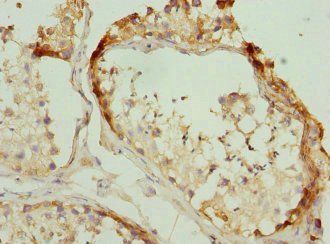 RPLP2 Antibody